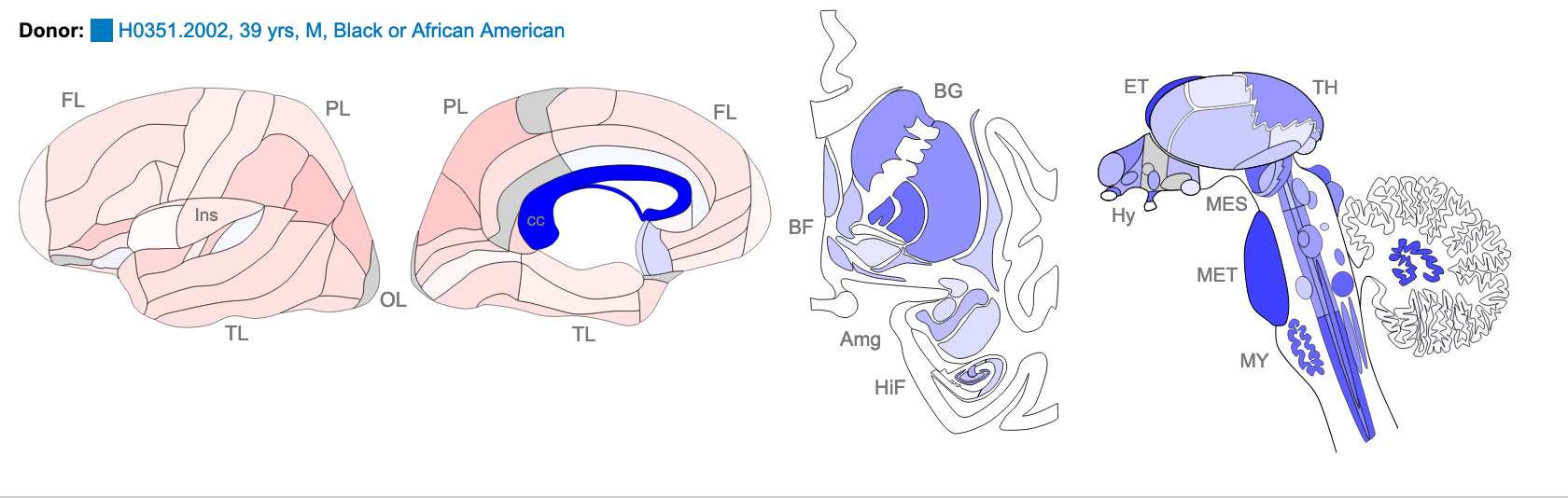 hbrain_A_23_P343559